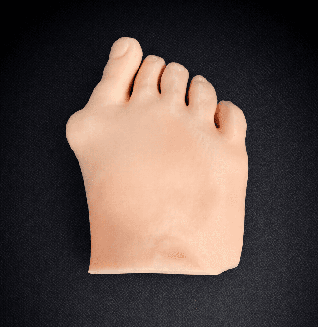 Hallux Valgus Trial – Swatches